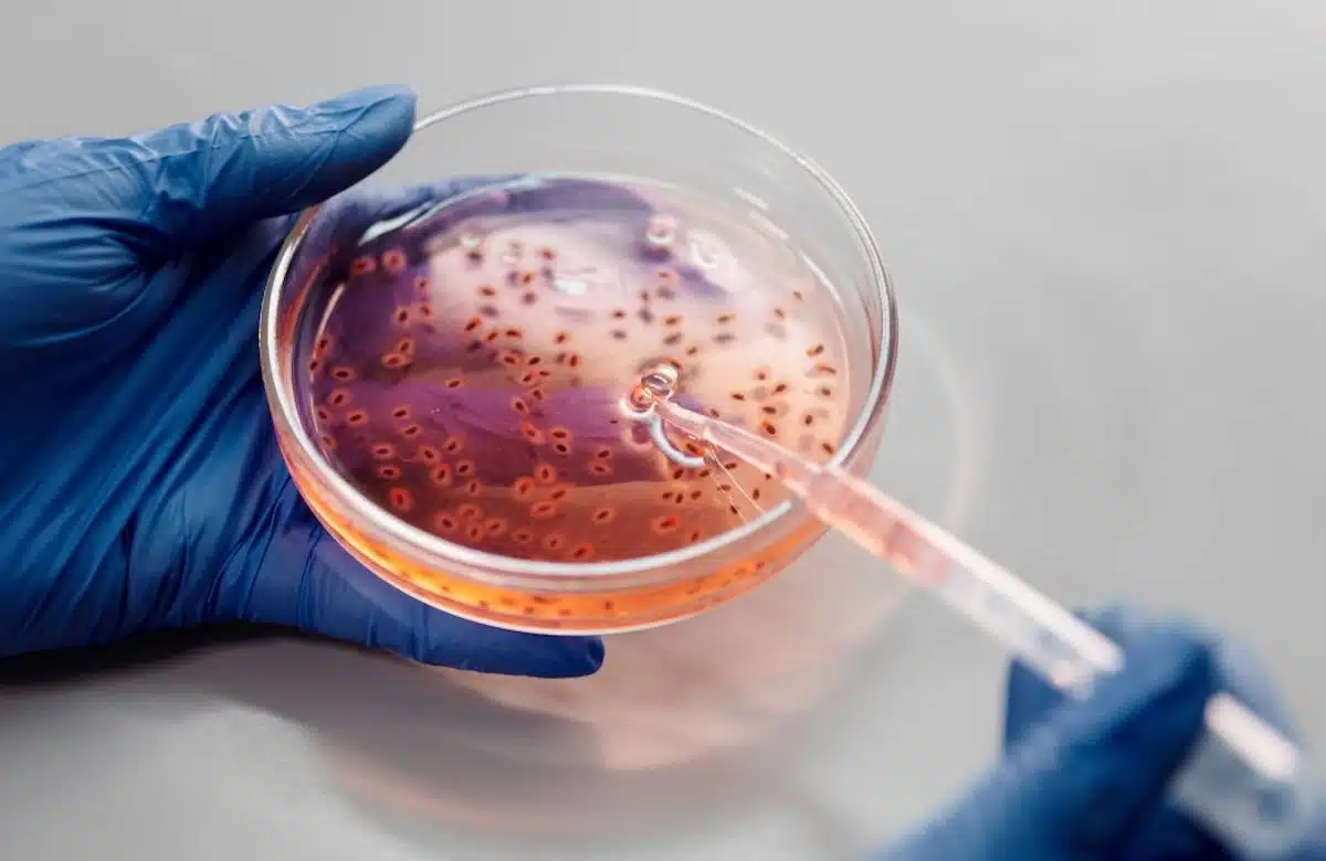 Épidémie de diphtérie en Guinée : une situation inquiétante