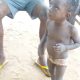 Insolite : Un enfant retrouvé vivant dans une fosse septique à Anouenou, frontière Togo-Ghana