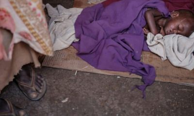 Santé : L’Ethiopie face à une épidémie de rougeole dévastatrice
