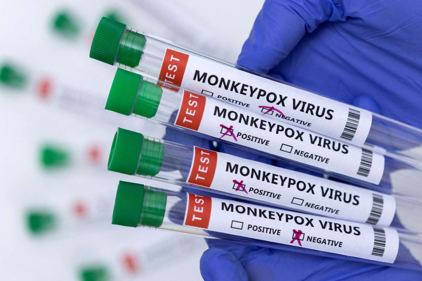 Variole du singe : Une première livraison de vaccins, une lueur d’espoir pour l’Afrique