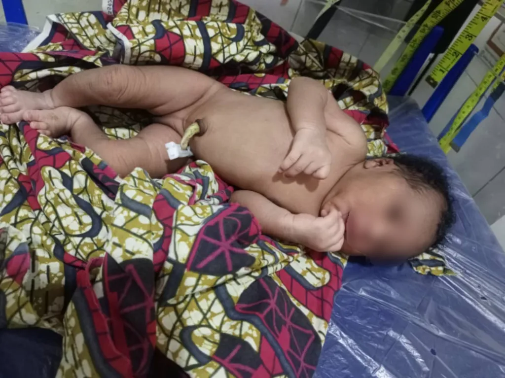 Kara : un nouveau-né découvert abandonné sous un abri de Tchoukoutou