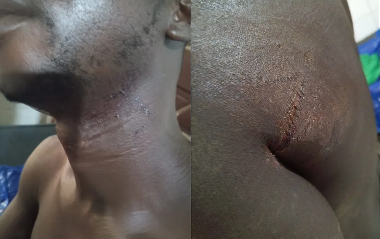 Tentative d’assassinat à Lassa : le président cantonal de Togo Espoir victime d’une attaque à la machette