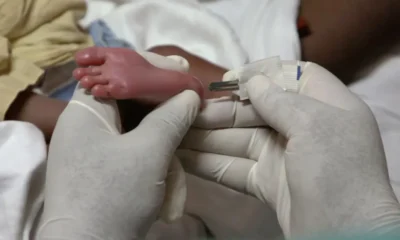 Togo : La drépanocytose désormais dépistée et traitée gratuitement