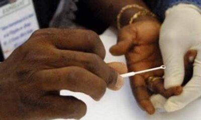 Togo : la drépanocytose touche des milliers d’enfants, un projet lancé pour renforcer le dépistage
