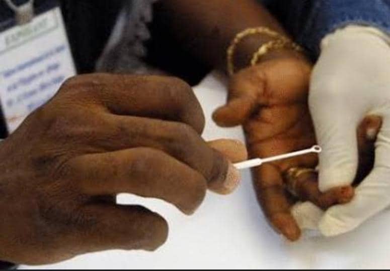 Togo : la drépanocytose touche des milliers d’enfants, un projet lancé pour renforcer le dépistage